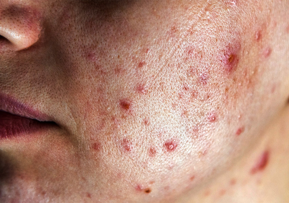 Dermatology Clinic